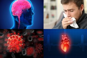 Nuo uoslės praradimo iki rimtų plaučių ligų: įspėjo, kas gresia persirgusiems koronavirusu