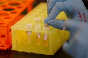 Lenkija iš statistikos išbraukė net 230 tūkst. koronaviruso testų: pranešė apie klaidą