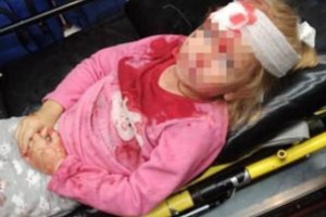 Baltarusija šokiruota: protestų metu buvo sužalota 5-metė