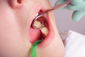 Vaikų sveikatos pažyma: penki patarimai, kad vizitas pas odontologą būtų lengvesnis