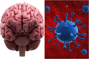 Mokslininkai: skrodimai atskleidžia baisią žalą, kurią smegenims gali padaryti koronavirusas