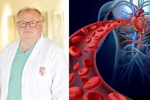 Kauno klinikų profesorius – apie naują būdą pašalinti kalcio sankaupas iš kraujagyslių be operacijos