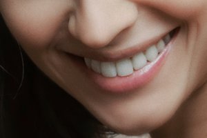 „Graži šypsena yra balta“: nuo skaidrumo iki burnos sveikatos