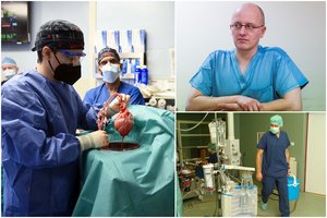 Po istorinės operacijos JAV – medikų reakcija: kada lietuviai žmogui persodins gyvūno širdį