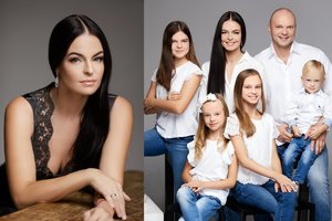 Kristupo Krivicko žmona Jurgita – apie plastines operacijas: „Svarbu geras specialistas ir saikas“