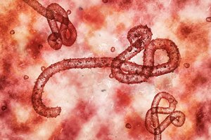 Ganoje pirmą kartą užfiksuotas mirtinai pavojingas Marburgo virusas