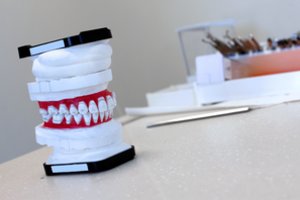 Ligonių kasos primena: pakartotinai valstybės lėšomis protezuoti dantis galima po 3 metų