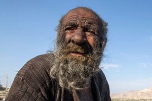 Mirė „purviniausias pasaulio žmogus“, nesimaudęs daugiau kaip 60 metų