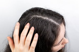 Galvos odos sudirgimas ir niežėjimas: ar gali padėti ne tik šampūnas? 
