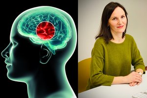 Pasauliui liaupsinant dar neregėtą vaistą nuo Alzheimerio ligos – neurologų verdiktas: atsakė, ar toks gydymas turi ateitį Lietuvoje