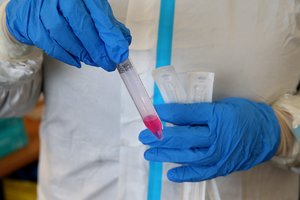 „Bona diagnosis“ valstybei vis dar negrąžino COVID-19 testų byloje priteistų 4 mln. eurų