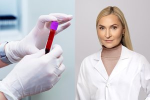 Kraujo vėžys, anemija ir infekcijos: kokias ligas leidžia įtarti bendras kraujo tyrimas