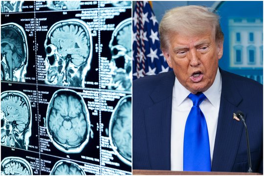 D. Trumpo prašymas ligoninėje pritrenkė gydytojus: visi aplink tik gūžčiojo pečiais 