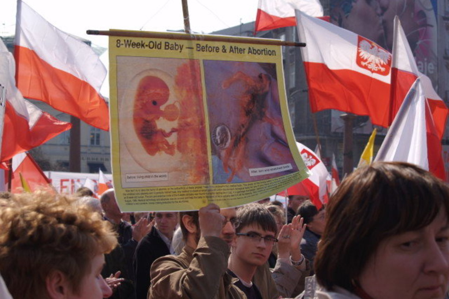 Tikintieji demonstracijoje Varšuvoje reikalauja neleisti abortų daryti net išaiškėjus, kad vaisius bus apsigimęs, ar kilus pavojui motinos sveikatai.