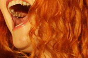 Raudonplaukiai dažniau vengia vizitų pas dantų gydytoją ir labiau bijo skausmo