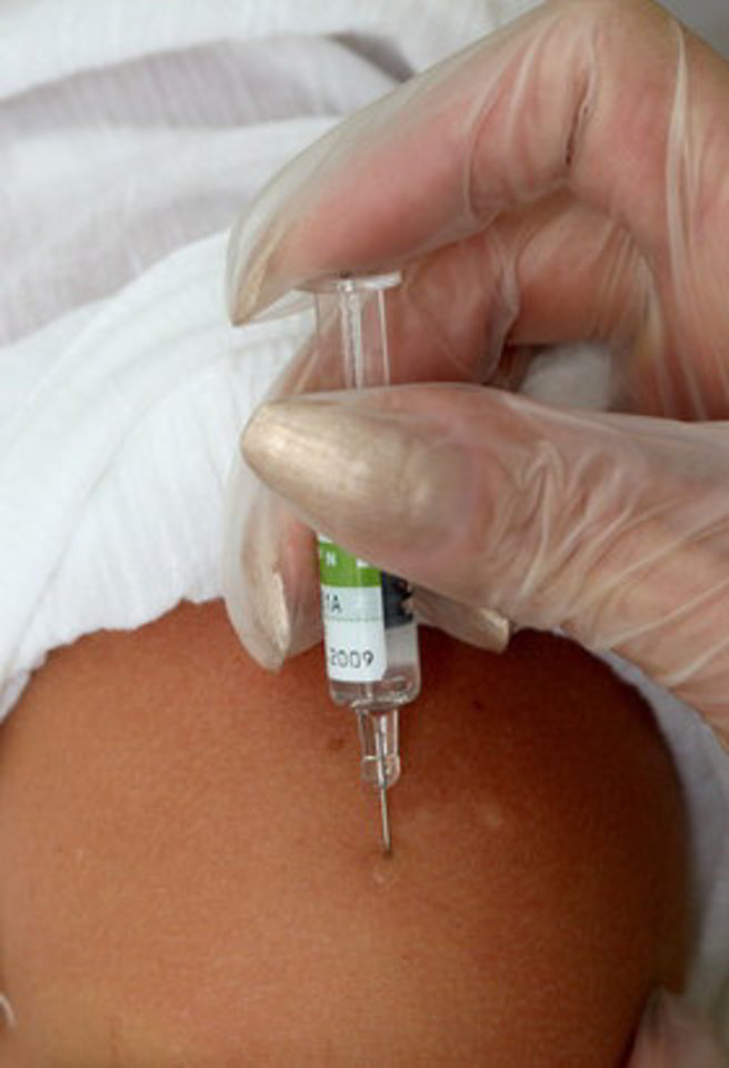 Iš viso Lietuva už 1 mln. litų iš Nyderlandų vyriausybės įsigijo 27 tūkst. dozių vakcinos nuo pandeminio gripo.