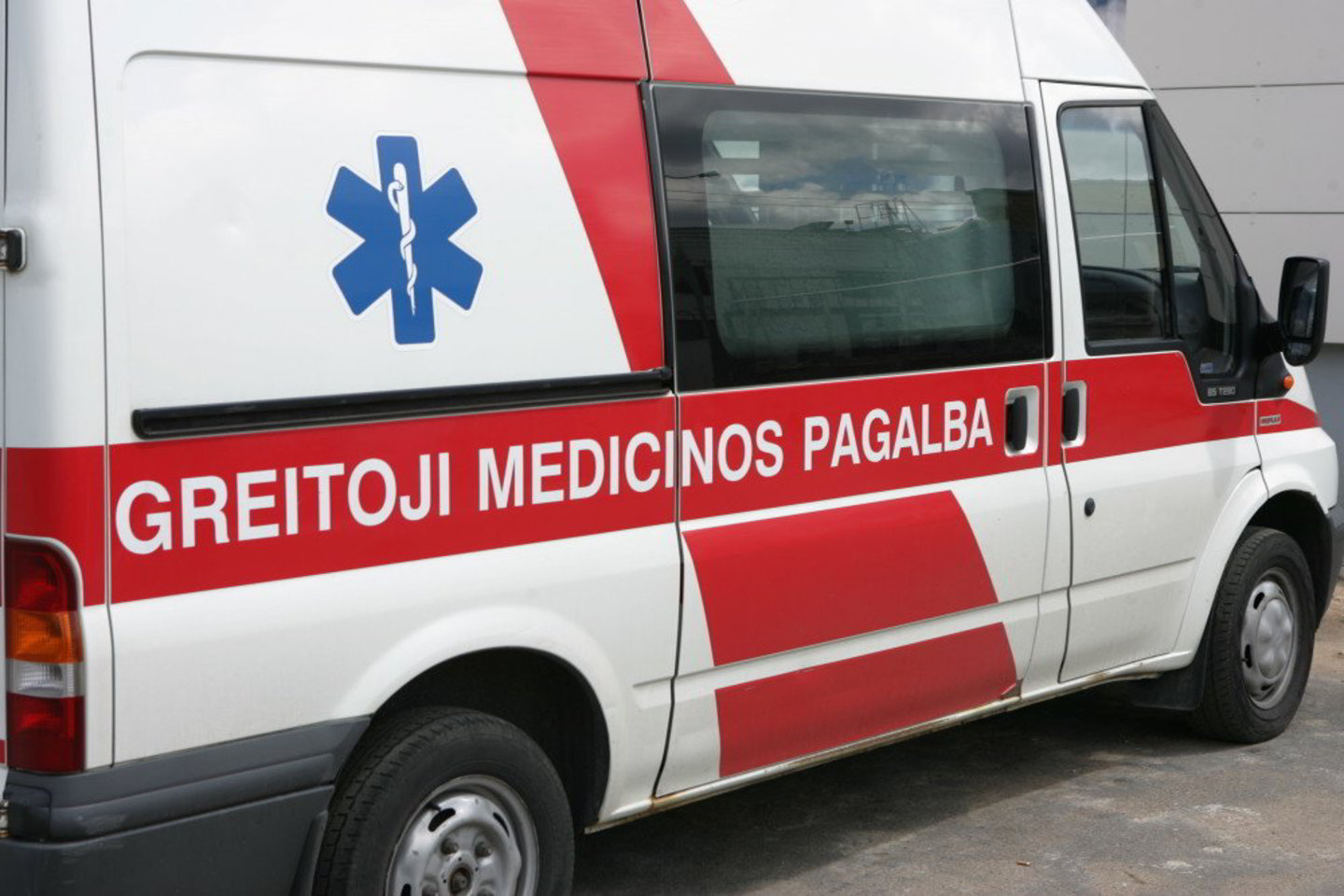 Medikai paauglei diagnozavo galvos smegenų sukrėtimą bei bendrą kūno sumušimą.