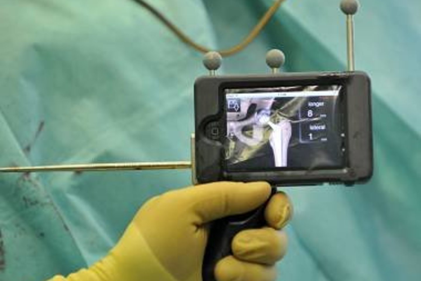“iPod” naudojimas ne tik muzikai klausyti, filmams žiūrėti, elektroniniams laiškams rašyti, bet ir klubų bei kelių operacijoms atlikti.