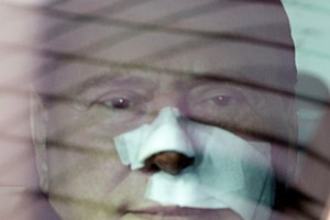 S.Berlusconi atlikta žandikaulio operacija