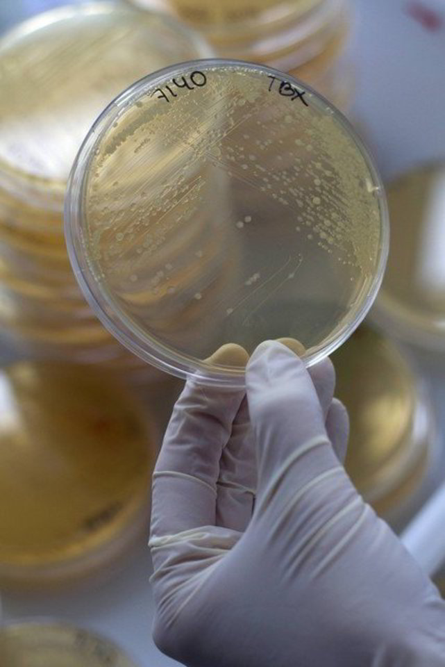 Vokietijos laboratorijose tebeieškoma, kas sukėlė žarnyno infekcijų protrūkį.