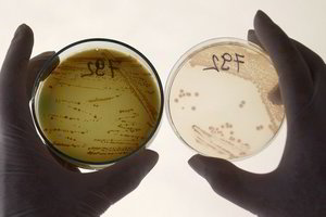 E.coli bakterija gali slėptis geriamajame vandenyje