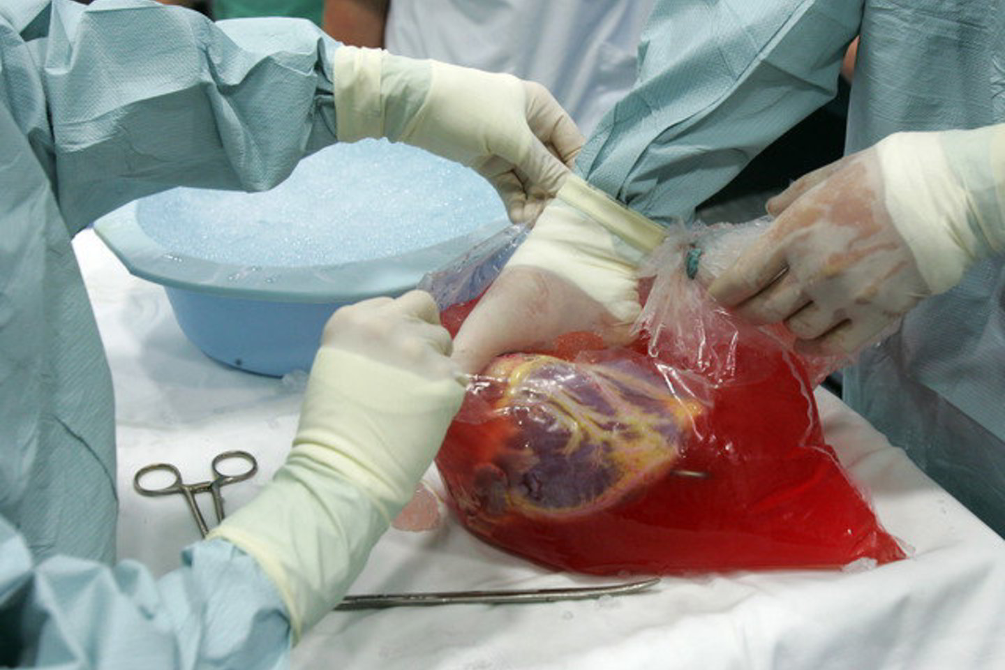 Vokietijos medikai iš Lietuvos širdį transplantacijai išskraidino savo lėktuvu.