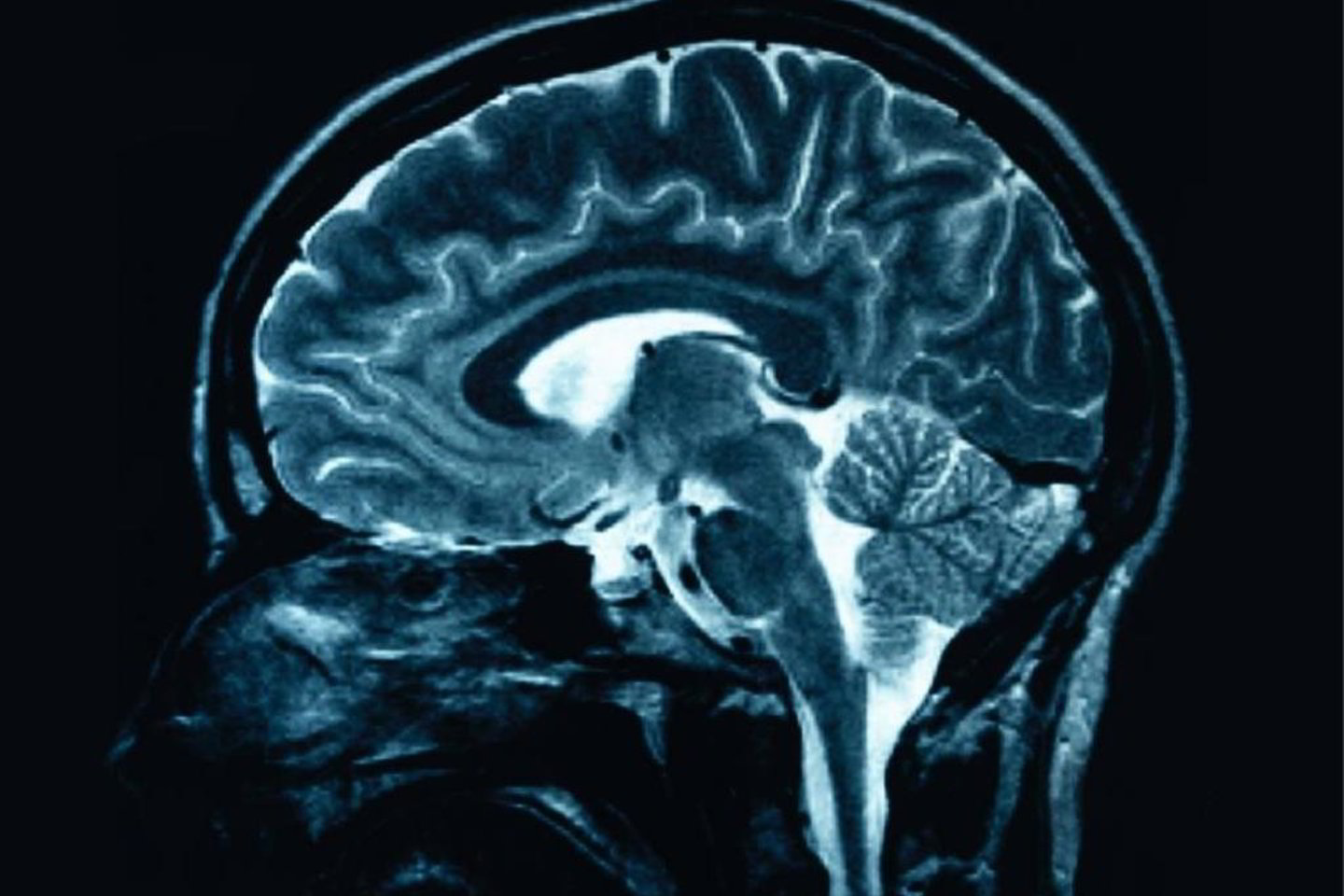 Mikroschemos veiks panašiai kaip žmogaus smegenys
