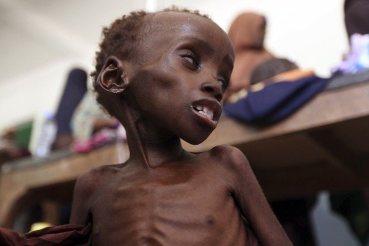 Eritrėja neįsileidžia JT agentūrų ir iš šalies išsiuntė daugumą humanitarinės pagalbos organizacijų atstovų.