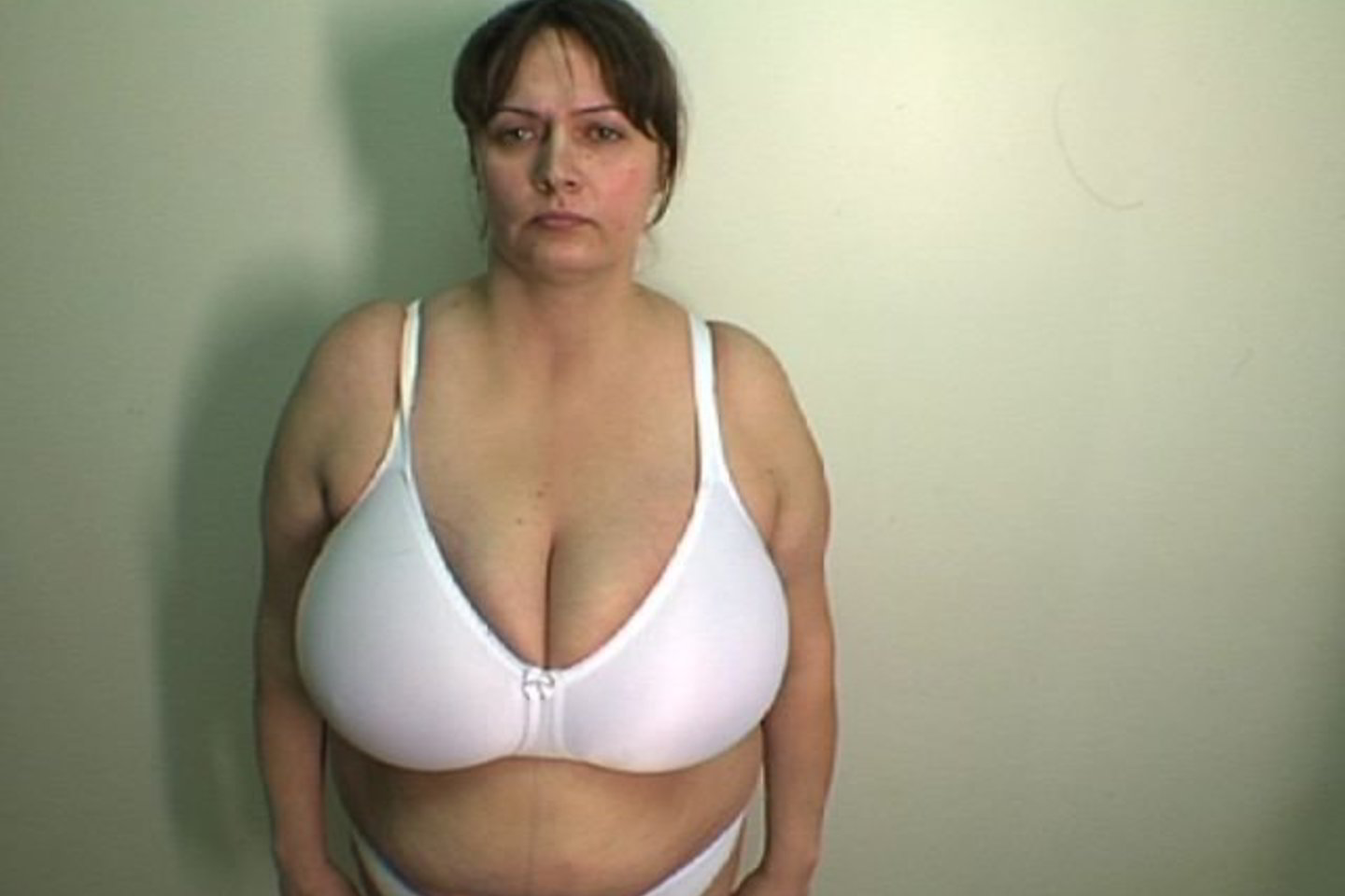 Audronė pasakojo, kad jau paauglystėje turėjo nemažą biustą, o po gimdymo krūtys dar labiau padidėjo.
