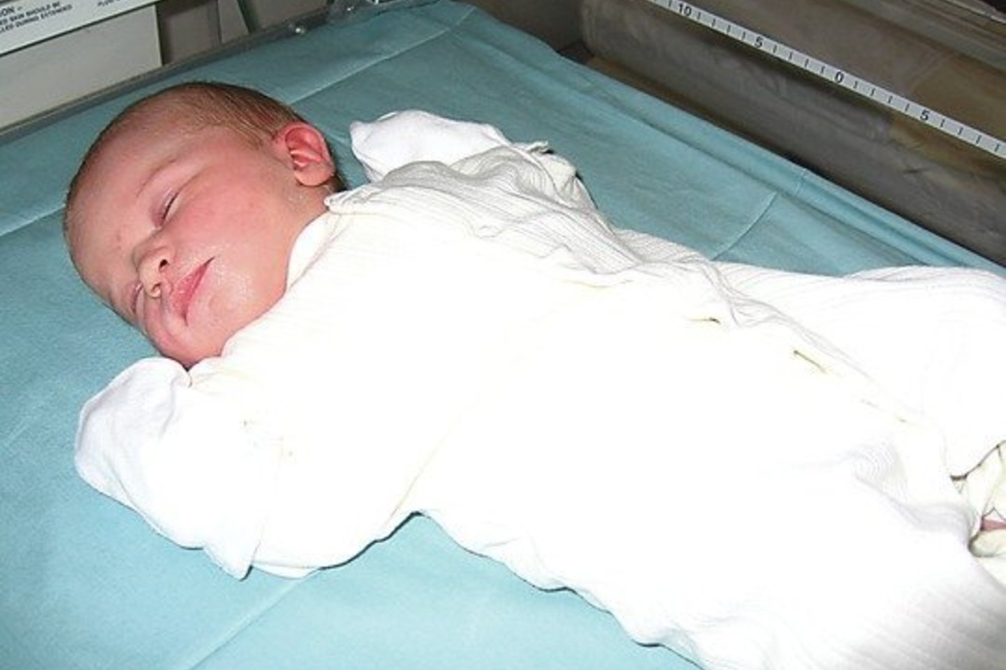 Tolmedzo ligoninei vieno kūdikio gimimas tapo netikėta našta.