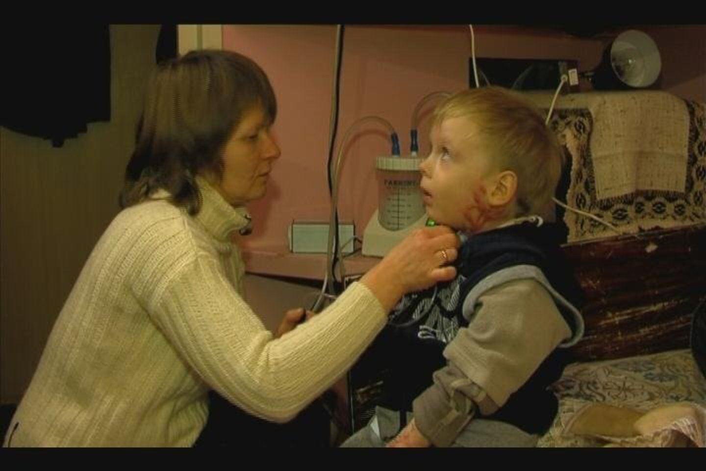 Apdegęs daugiau nei 40 procentų kūnelio dabar Deivydas gali kvėpuoti tik su specialia įranga, o kalbėti – pašnabždomis.