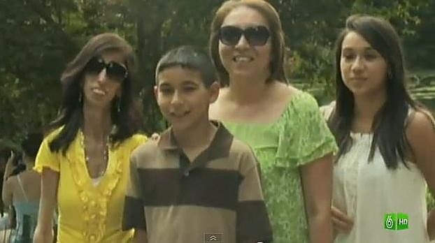 Retą sindromą turinti amerikietė išmoko nereaguoti į patyčias