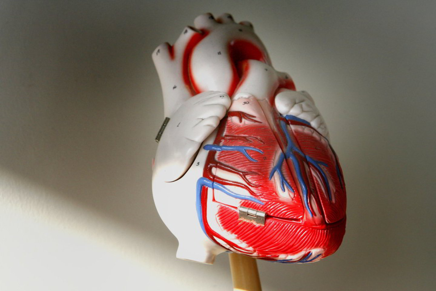 Ne visos moterys žino, kad pagrindiniai širdies ligų ir insulto rizikos veiksniai yra aukštas kraujospūdis, didelis cholesterolio kiekis kraujyje, cukrinis diabetas, rūkymas, mažas fizinis aktyvumas, nesveika mityba, sukelianti nutukimą ir antsvorį.