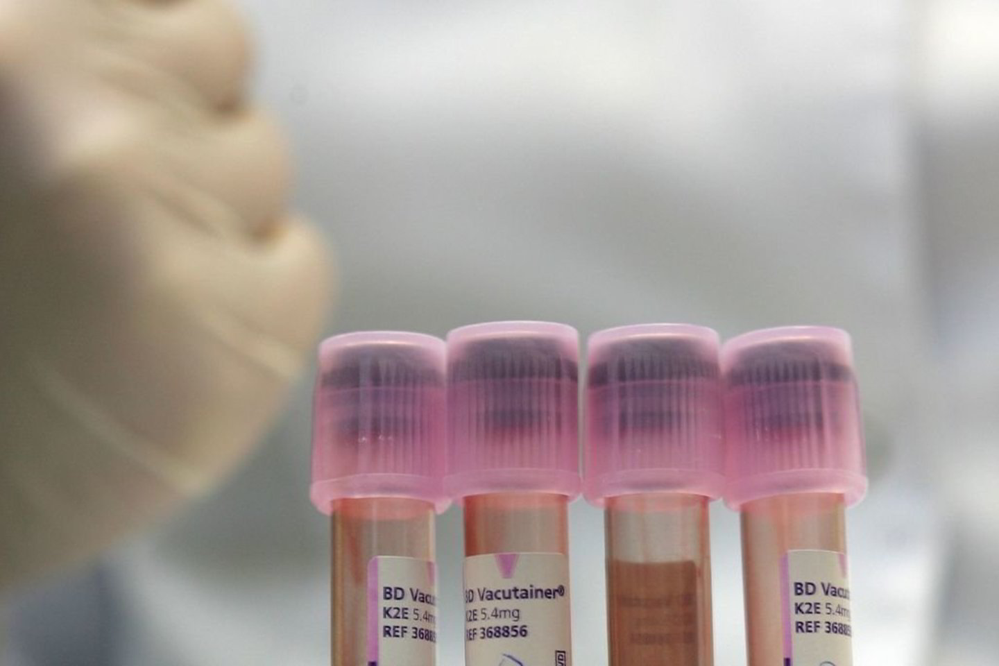Vaikinas tvirtino niekada nebuvęs Mančesteryje, bet kompanija „LGC Forensics“, kasmet atliekanti testus tūkstančiams bylų, tvirtino, kad DNR atitikimas nekelia abejonių.