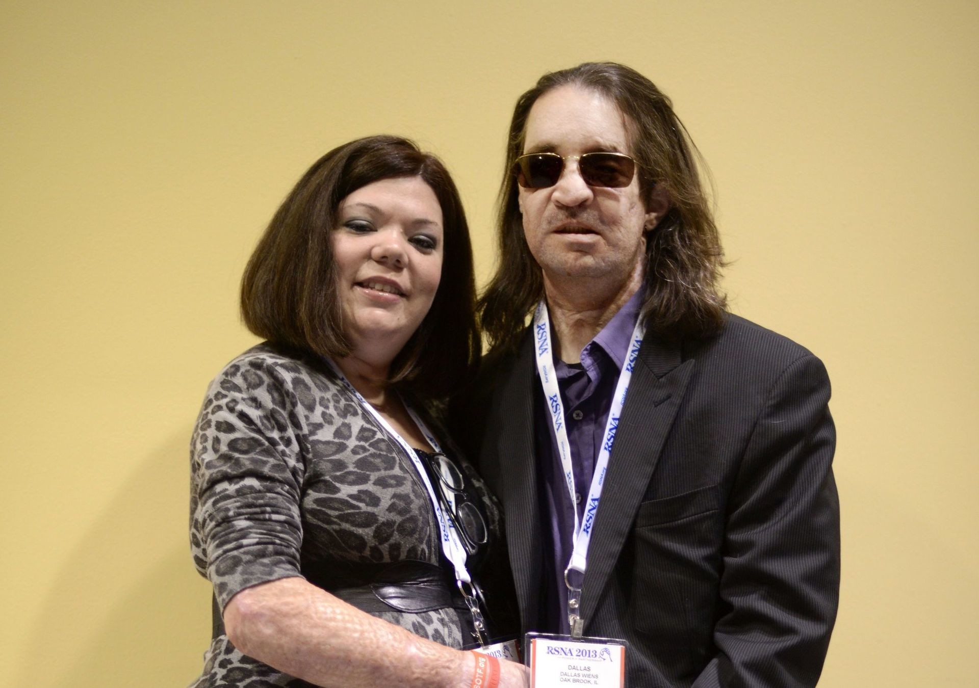 Amerikietis, kuriam buvo persodintas veidas, pasirodė su nauja žmona ir šunimi