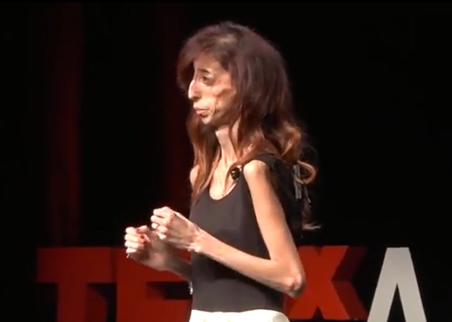 Bjauriausia pasaulyje moteris tūkstančius įkvepia džiaugtis gyvenimu