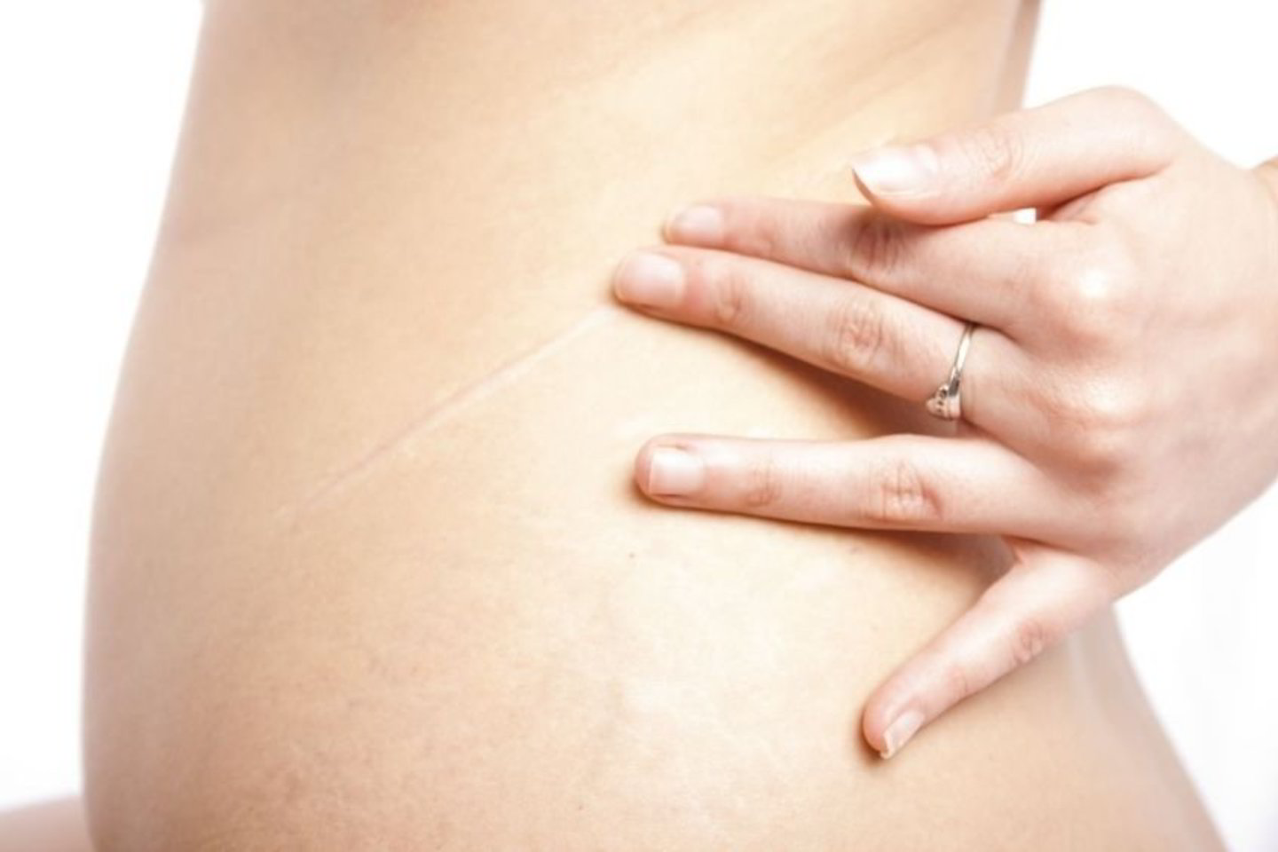 Operacijos be randų: vidiniai organai pašalinami per burną ir vaginą.