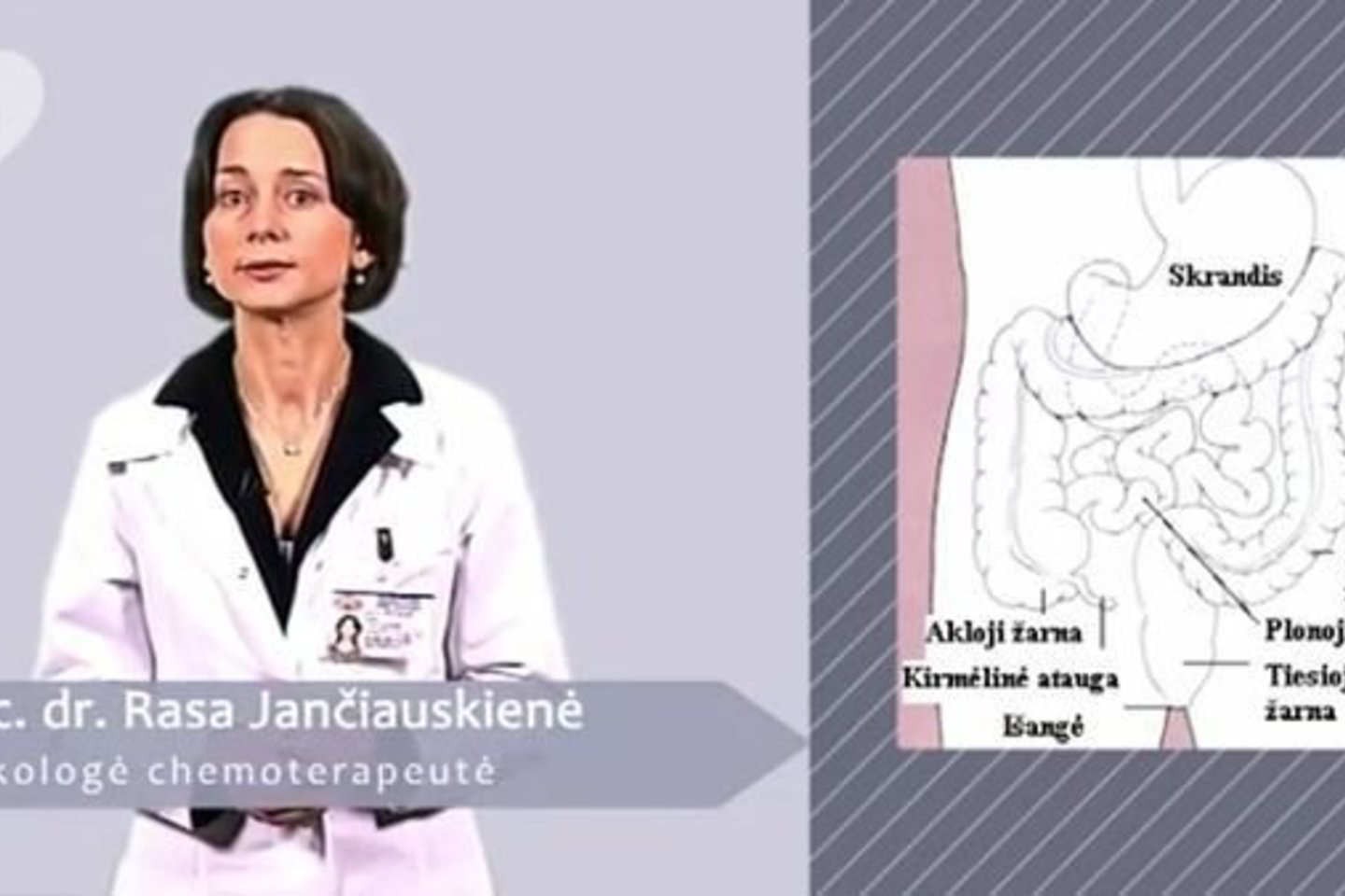 Prie vėlyvo ligos diagnozavimo, pasak dr. R. Jančiauskienės, prisideda ir tai, jog apie žarnyno vėžį neretai vengiama atvirai kalbėti.