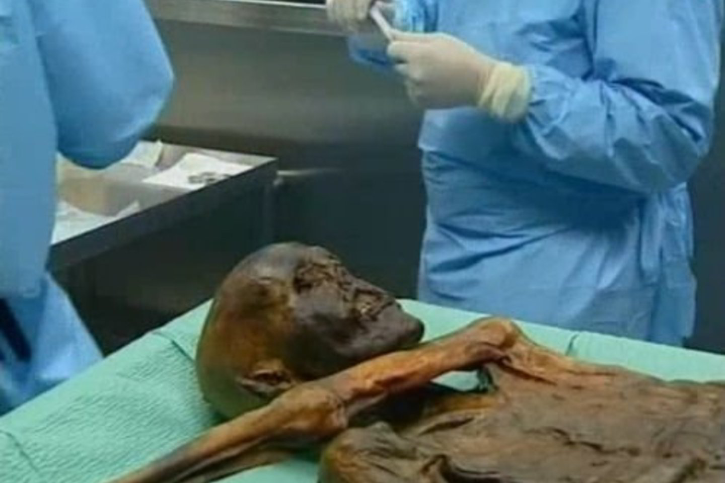 Alpėse rastas prieš 5300 metų žuvęs žmogus artimesnis Korsikos ir Sardinijos, o ne Alpių gyventojams