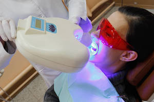 Burnos ir dantų ligos: kaip jas atpažinti ir išgydyti?