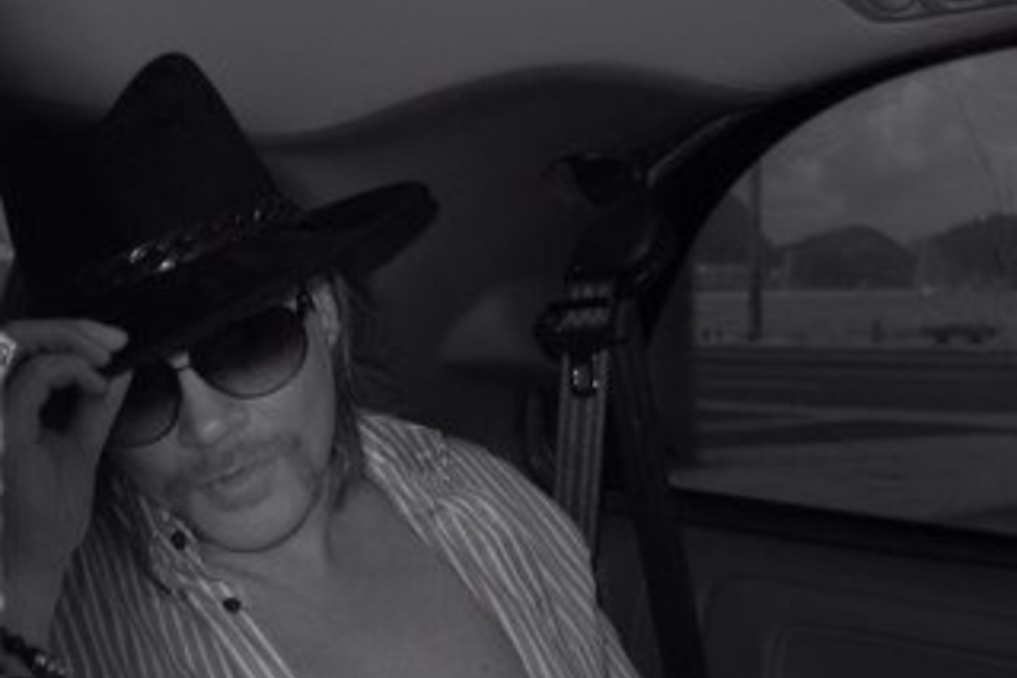 Roko žvaigždė Axlas Rose'as gydosi didelę mėlynę ant savo kairės kojos po audringo savaitgalio Rusijoje.