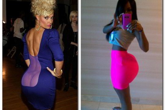 Silikoninių krūtinių banga atslūgo – tegyvuoja dideli užpakaliai