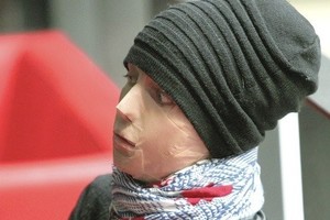 Sieros rūgštimi merginą apipylusio vyro pasakojimai bliūkšta