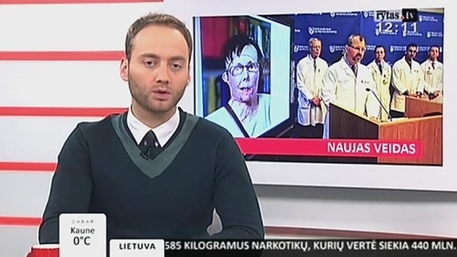 „Lietuvos diena“: Jungtinėse Valstijose moteriai atlikta sudėtinga veido transplantacijos operacija (I)