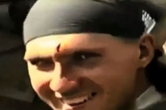 Iš kaktos replėmis išlupus kulką, rusų kareivis šypsosi į kamerą