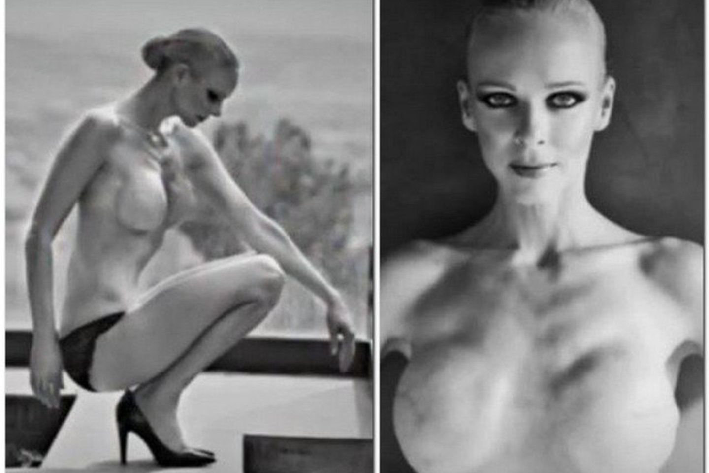 Modelis Claire Farwell, prieš keletą metų nugalėjusi krūties vėžį, liovėsi pergyventi dėl pooperacinių randų.