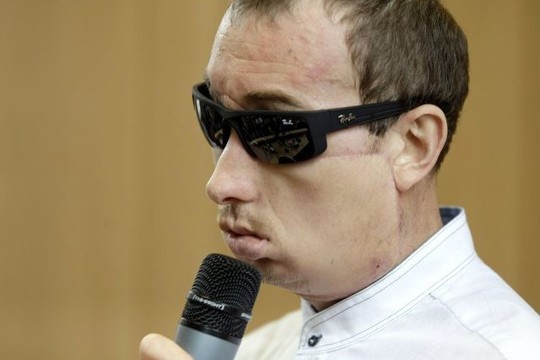 Pirmosios Lenkijoje veido transplantacijos pacientas išrašytas iš ligoninės