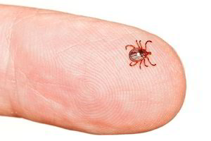 Sostinėje ir apylinkėse daugėja užsikrėtusių Laimo liga