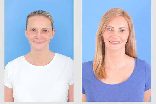 Po plastinių operacijų V.Jakutienės mama atjaunėjo dešimčia metų