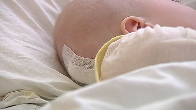 Mįslinga trauma: dešimties mėnesių kūdikis – su kaukolės lūžiu